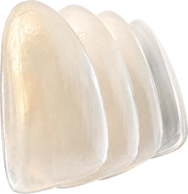 Porseleinen facings (E-MAX)